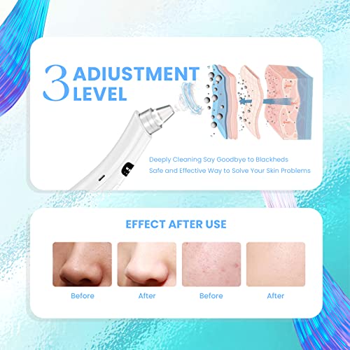 2023 Newest Blackhead Remover Pore Vacuum,Facial Pore Cleaner-5 Suction Power,5 Probes,Usb Rechargeable Blackhead Vacuum Kit Electric Acne Extractor Tool For Adult #TOP2