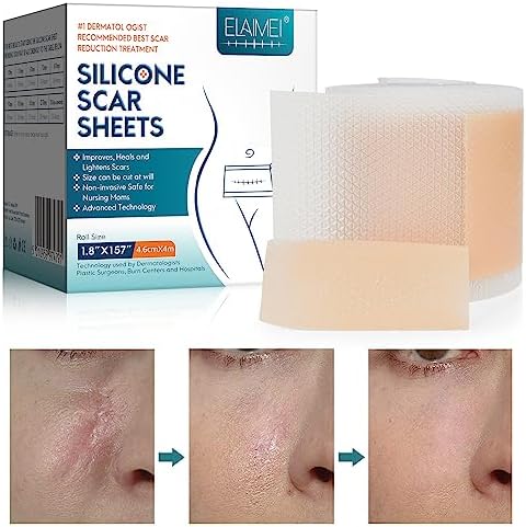 Scar Away Silicone Scar Sheets(1.8"x157"-4M),Medical Grade Silicone Scar Tape,Silicone Strips for Scar Healing,Painless Scar Removal Tape for All Surgical Incisions,C-Section,Burn,Keloid,Acne