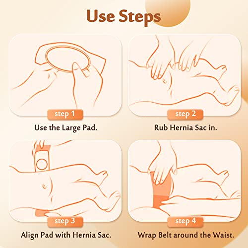 image for Mybow Umbilical Hernia Belt Baby Belly Button Band Newborn Cover Infan