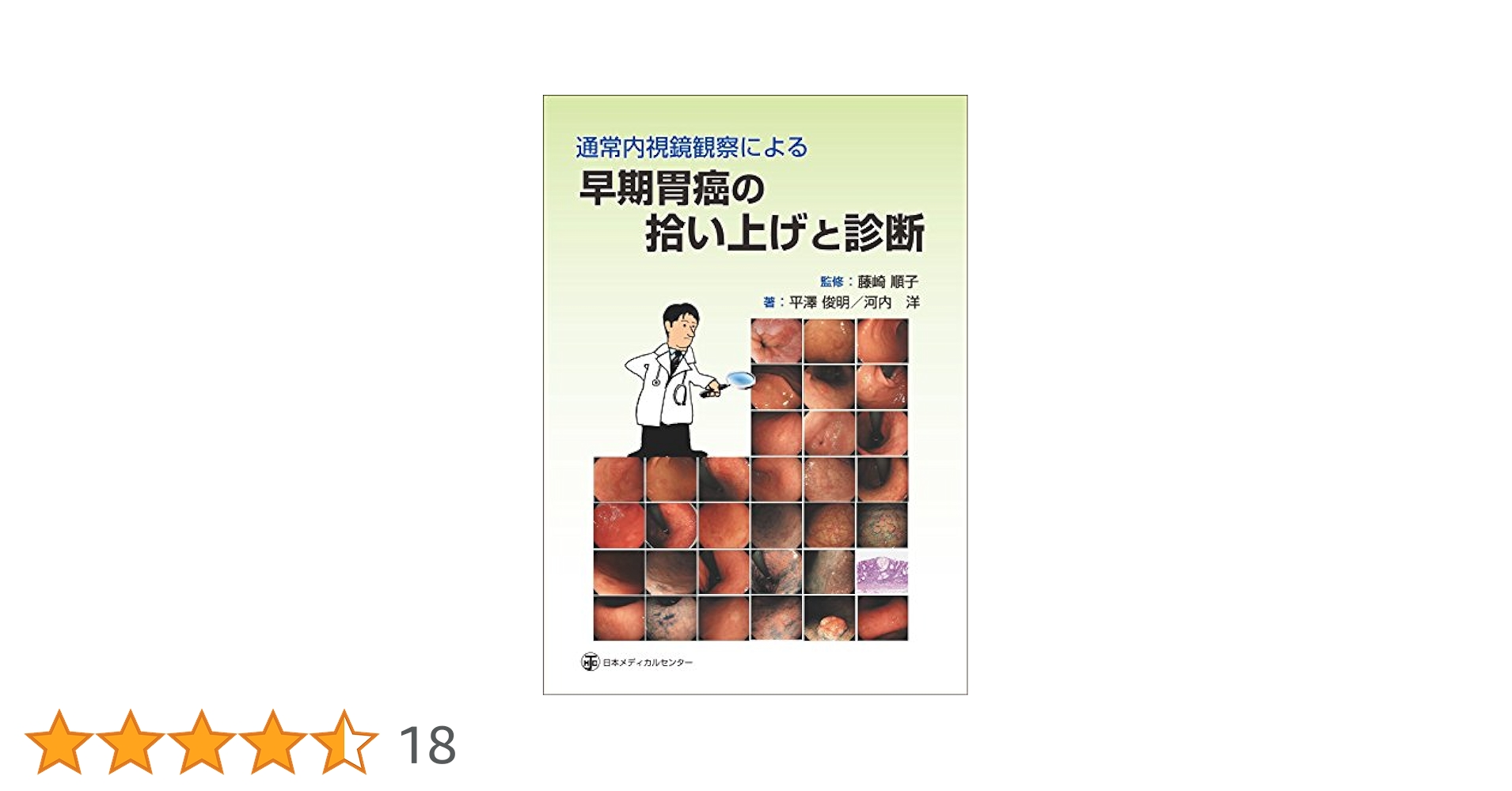 通常内視鏡観察による早期胃癌の拾い上げと診断 平澤 俊明、 河内 洋; 藤崎 順子 通常内視鏡観察による早期胃癌の拾い上げと診断 | 平澤 俊明