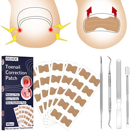 FANTESI Toenail Correction Patch, Ingrown Toenail Stick Patch, 50 Pcs Elastic Patch Curved Toenails Brace Stickers With 4 Pcs Nail Correction Tool for Men Women Toenail Care Tool