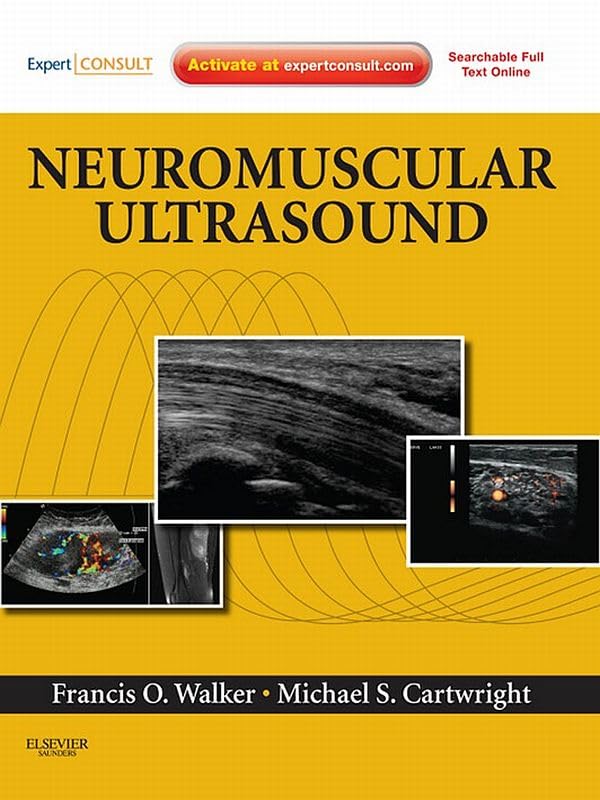 Neuromuscular Ultrasound E-Book: Expert Consult - Online and Print (English Edition)