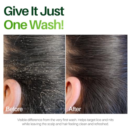 Image of Botanical Luxuriate Tea Tree 100% Natural Anti Lice and Nits Shampoo 100ml With Tea Tree and Neem Extracts