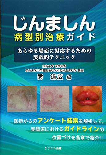 PDFダウンロード じんましん病型別治療ガイド あらゆる場面に対応するための実戦的テクニ バイ