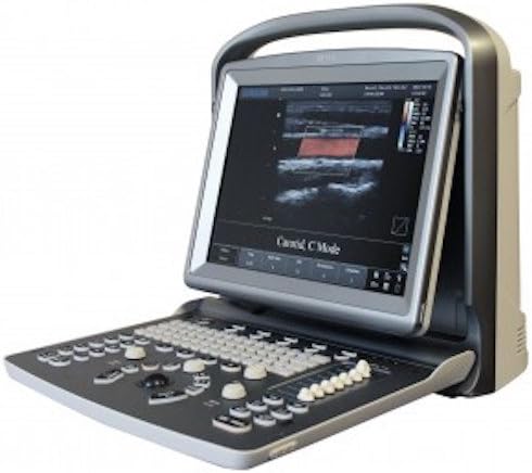 Chison Refurbished ECO5 Portable System