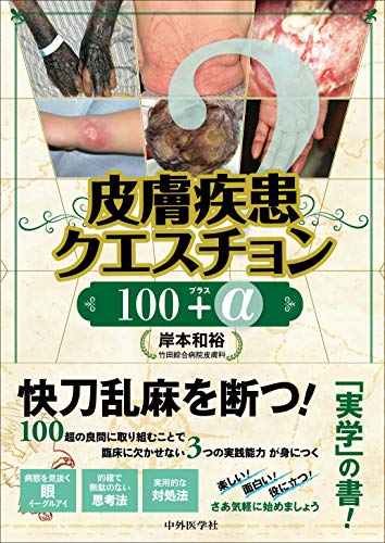 無料電子書籍 pdf 皮膚疾患クエスチョン100プラスα バイ