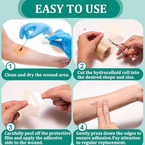Image of Hydrocolloid Roll, Waterproof Hydrocolloid Tape for Skin Protection, Gentle Bandage for Active Children and Sensitive Skin, 10 cm x 100 cm
