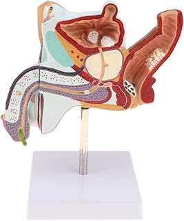 ZBCKKING 3D Human Organ Model,Male Reproductive System Genital Organ Pathology Anatomical Model Human Urinary System Lesion Teaching Tool for Medical Education Demonstration