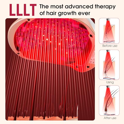Image of Laser Hair Growth Helmet, Laser Red Light Therapy for Hair Growth, Laser Cap for Hair Regrowth Stimulate Denser Fuller Hair,256 Laser Diodes