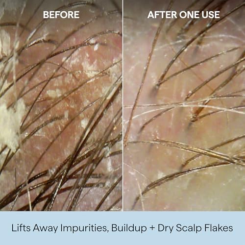 Image of Briogeo Scalp Revival Charcoal + Coconut Oil Micro-Exfoliating Shampoo | Sulfate-Free Scalp Scrub for Dry, Itchy, or Oily Scalp | Detoxifying & Hydrating | Vegan & Cruelty Free
