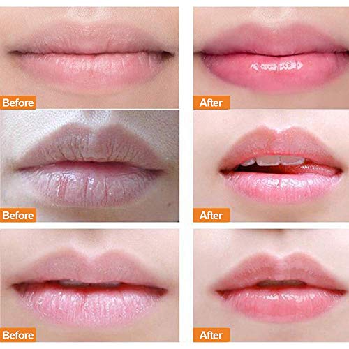 Lip Scrub, Lip Treatment Soothing Moisturizing Lip Mask For Chapped And Cracked Lips, Younger Looking Lips Overnight, Restore & Plump Dry, Anti-Wrinkle, Anti-Aging, Exfoliating Lip Cream (Strawberry) #TOP5