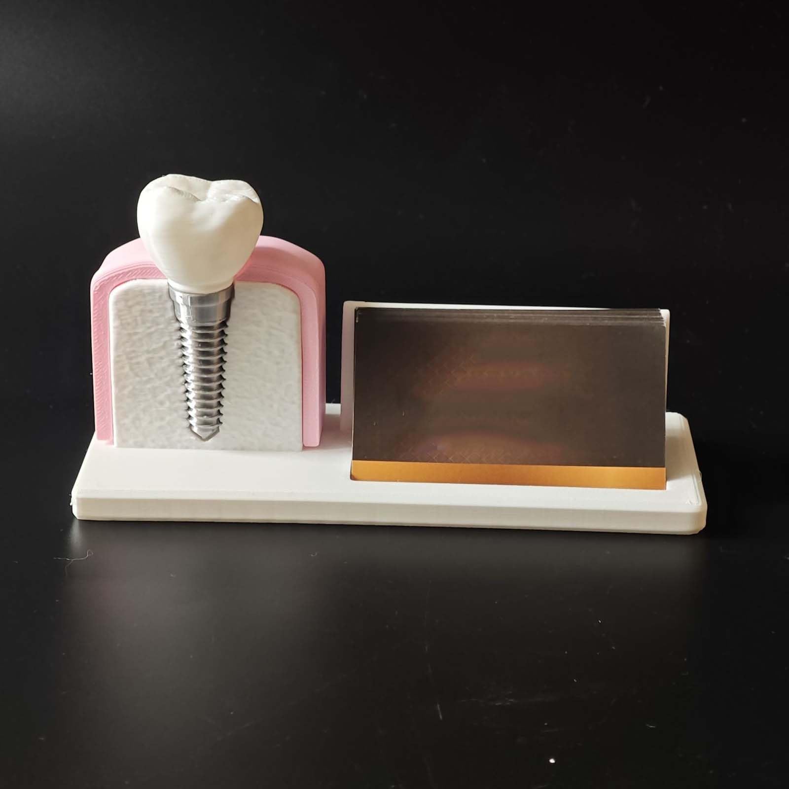 Portatarjetas de Visita de Clínica Dental Modelo de Implante Dental y Conducto Radicular para Hombres y Mujeres Soporte de Escritorio para Nombre Tarjeta Organizador de Tarjetas