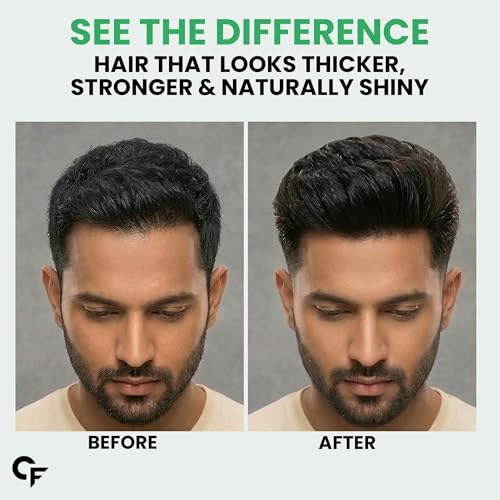 Image of Carbamide Forte Rosemary Hair Spray with Rice Water | Rosemary Water Spray for Hair Growth with Redensyl, Anagain & Baicapil | Supports Hair Density & Thickness | Water Based Formula for All Hair Types - 200 ml