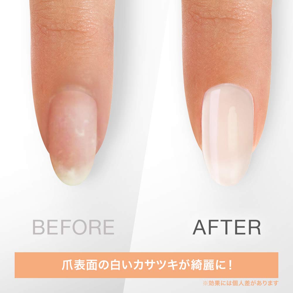 OPI Gel Break Treatment, Serum Base Coat, 0.5 fl oz : Beauty & Personal Care