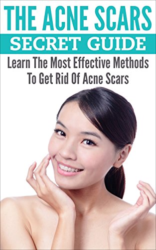 The Acne Scars Secret Guide: Learn The Most Effective Methods To Get Rid Of Acne Scars (Acne Treatments, Acne Cure, Acne Remedy Book 1) The Acne Scars Secret Guide: Learn The Most Effective Methods To Get Rid Of Acne Scars (Acne Treatments, Acne Cure, Acne Remedy Book 1)