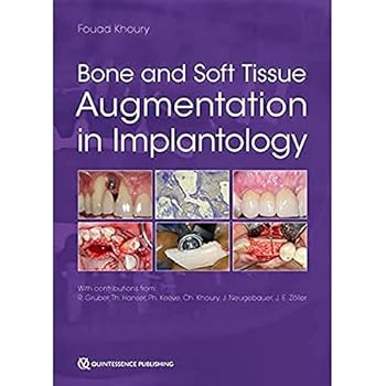 Hardcover Bone and Soft Tissue Augmentation in Implantology Book