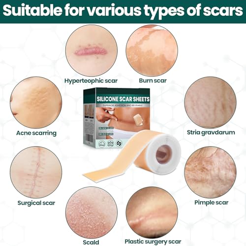 Bobopack Cerotti Silicone Cicatrici, 4X150Cm Fogli Di Silicone Per Cicatrici, Rotolo Di Nastro In Silicone Morbido,Scar Sheets,Per Cicatrici Causate Da Cesareo, Chirurgia, Ustioni - 6