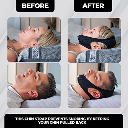 Dysnosis Chin Strap Chin Strap for Cpap Users Cpap Chin Strap Anti snoring Chin Strap