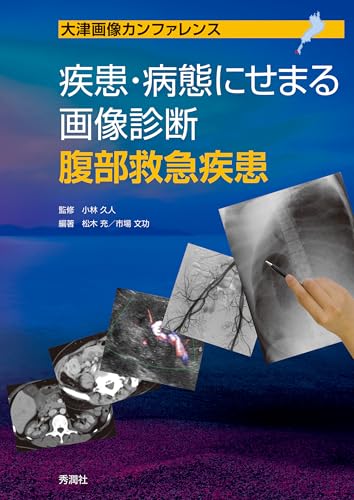 疾患・病態にせまる画像診断 腹部救急疾患 (大津画像カンファレンス)