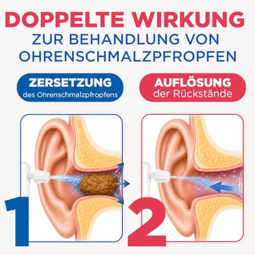 AUDISPRAY Ultra - Behandlung von Ohrenschmalzpfropfen - Schnelle Auflösung von Ohrenschmalzpfropfen - Ohr - Spray 20 ml