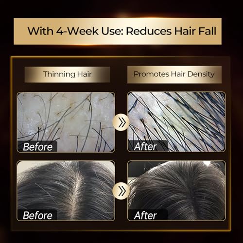 ZOOLY PROFESSIONAL Hair Regrowth Treatments Includes Scalp Massage Cream, Shampoo, Scalp Serum. Hair Strengthening Black Gold Series Hair Gift Set