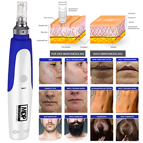 Elektrische Dermapen Koi Beauty Professionele microneedling voor thuis 0,25-2,0 mm Verstelbaar - 5 snelheidsniveaus… - Afbeelding 4