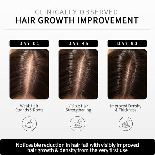 Image of Keanu Stem Cell Intensive Anti Hairfall Serum, Combats Hair loss, Boosts Hair Growth, Reactivates Dormant Follicles, Improves Density, No Minoxidil, Non Sticky, With Exosomes, For Men & Women 50ml