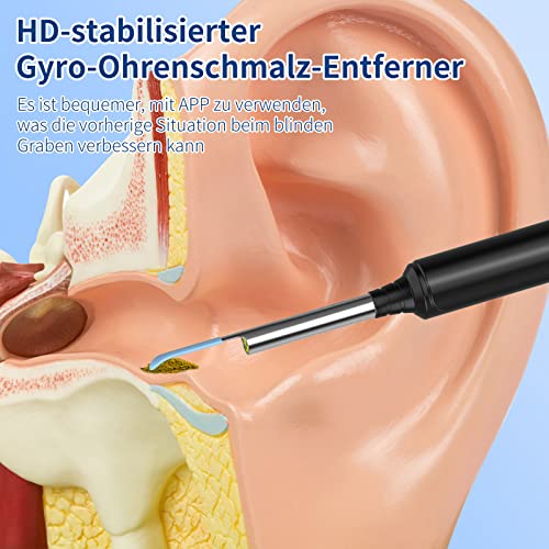 Ohrenschmalz Entferner Otoskop, VITCOCO WiFi Ohrenreiniger Kamera 5MP HD Ohr Kamera IP67 wasserdicht Ohrenspiegel 3.5mm Linse Ohr Endoskop mit 6 LEDs für iPhone, iPad und Android-Smartphones(Schwarz)