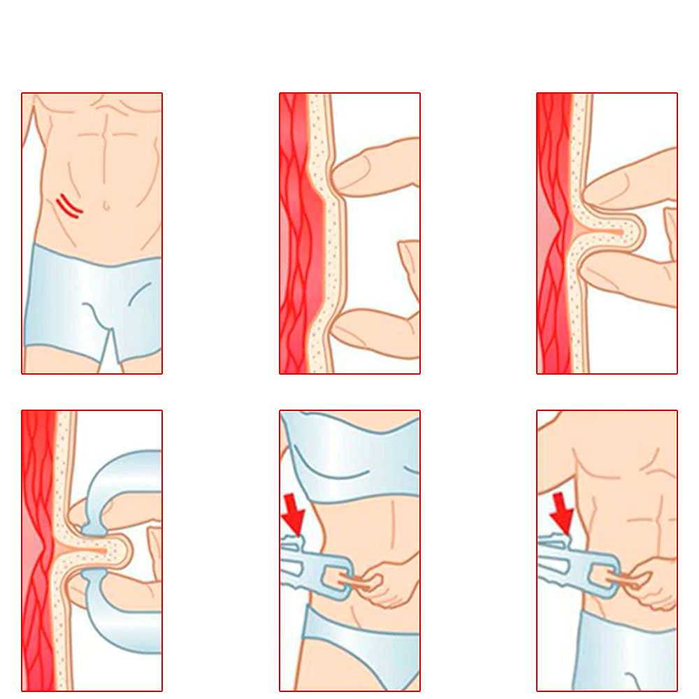 OcioDual Körperfettzange, Köperfettmessgerät, Fettmesszange, Caliper Zange, Körperfett, Fett Messgerät, Köperfett Messgerät, Anteil Messen Körper Massband Test, Schwarz