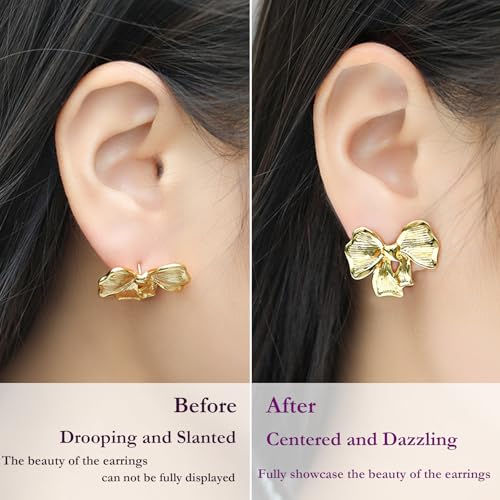 Parches para orejas caídas que evitan que se estiren los lóbulos con tus aretes 7