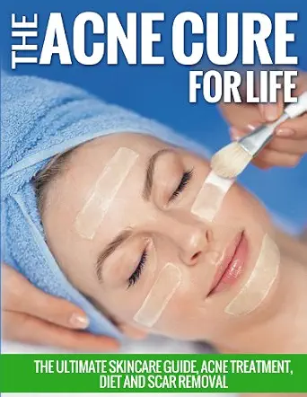The Acne Cure For Life: The Ultimate Skincare Guide, Acne Treatment, Diet and Scar Removal-Wow! eBook