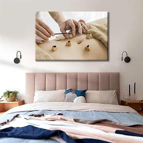 Image of TUMOVO 1 Panels Moxibustion Canvas Wall Art Moxa Moxibustion Posters Paintings for Wall Decorations Nosocomium Artwork Canvas Photo Stretched and Framed Ready to Hang (24 inch Wx36 H)