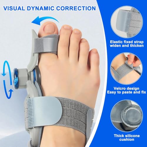 Férula giratoria universal para juanetes con corrector ajustable de pies 4
