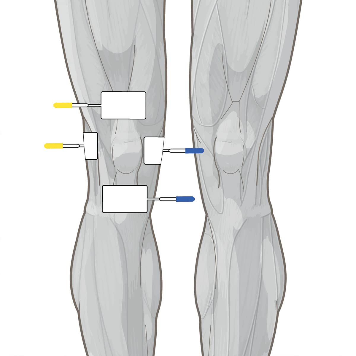 GLOBUS | Genesy S2, Electroestimulador de 2 Canales, 60 Programas para Fisioterapia