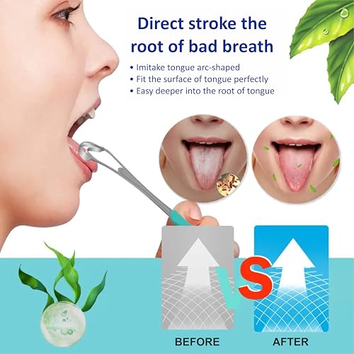 Image of 2 pcs spoon shap with silicon handle Tongue Scraper, 100% Useful Surgical Stainless Steel Tongue Cleaner for Both Adults and Kids, Professional Reduce Bad Breath Metal Tongue Scrapers, Help Your Oral Hygiene