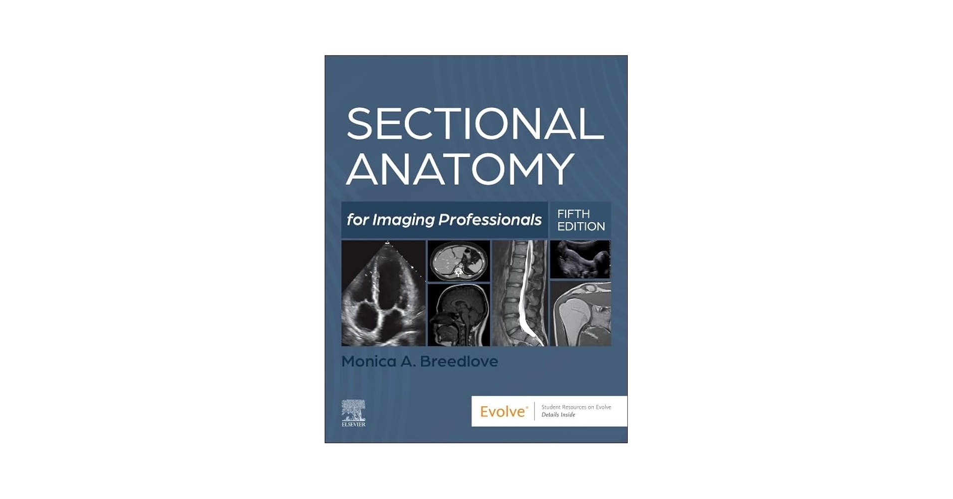 Sectional Anatomy for Imaging Professionals: 9780323827881