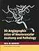 3D Angiographic Atlas of Neurovascular Anatomy and Pathology