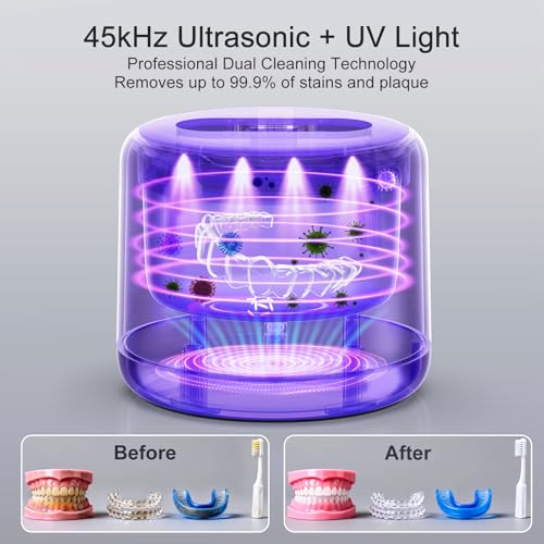 Ultrasonic Cleaner for Retainers