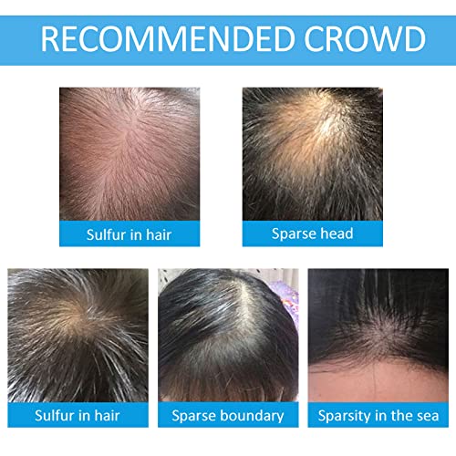 Shifakou Hair Building Fibers For Thinning Hair With Spray Applicator Pump Nozzle thumb #4
