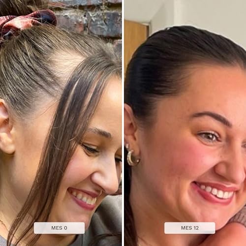 HAIR BURST Shampoo und Conditioner Set für Längeres und Stärkeres Haar mit Natürliche Wirkstoffe – Haarwachstum beschleunigen und Haarausfall vermeiden – Ohne SLS und Parabene (2 x 350ml)