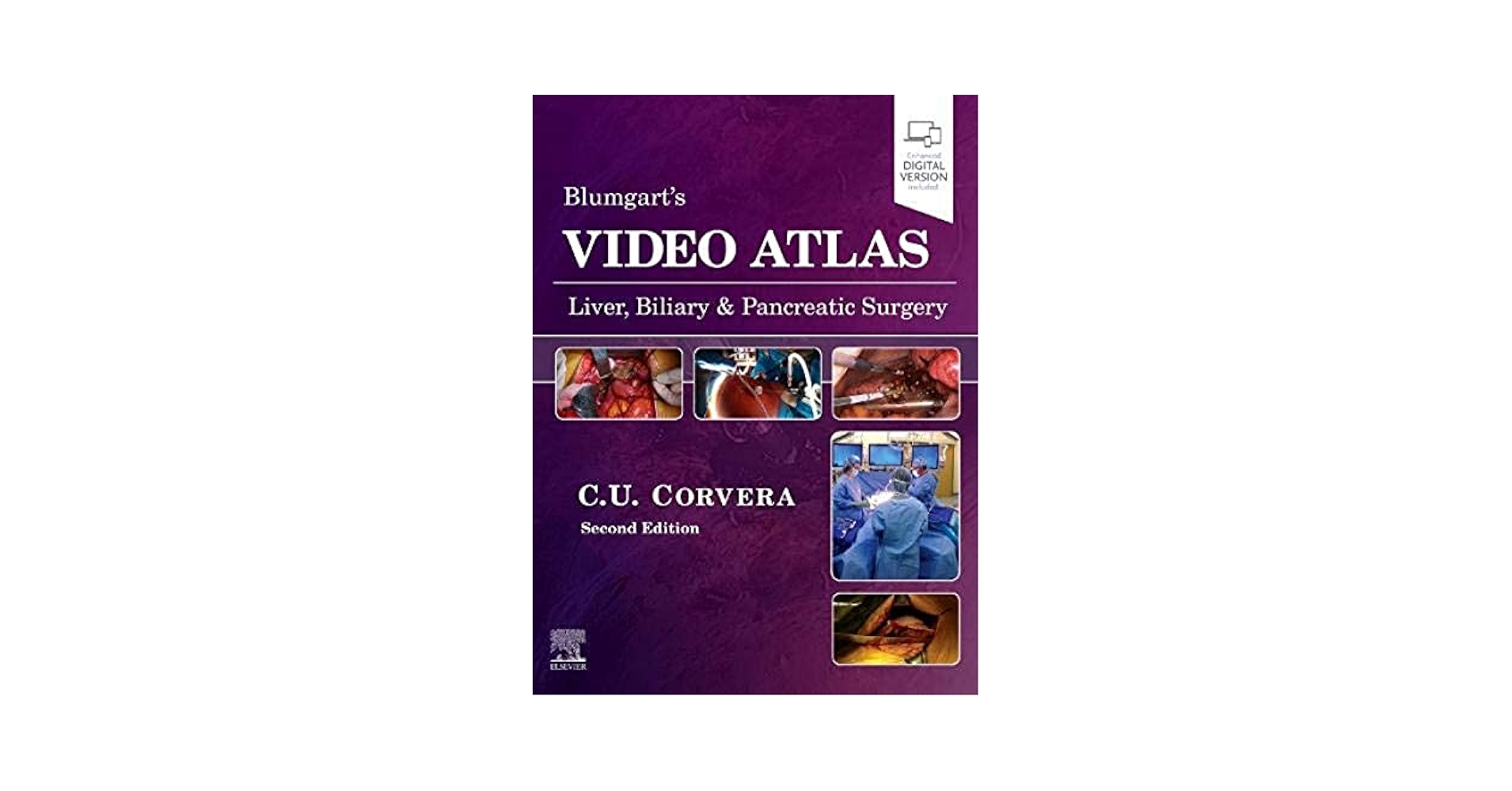 Atlas of Organ Transplantation (DVDなし） Atlas of Organ Transplantation | SpringerLink