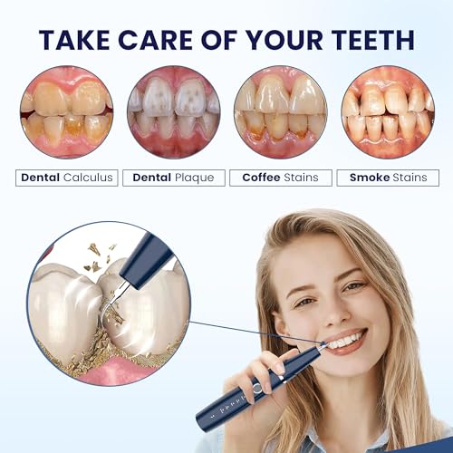 HOKIN Plaque Remover Dental Care Kit Teeth Cleaning Tool Dental Care Kit Tooth Filling Repair Set Stainless Steel Dental Tools for Men Women Kids and Pet Care (5) - Image 4