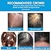 Hair Building Fibers with Spray, Hair Thickening Fibers for Thinning Hair & Bald Spots Thicker Fuller Hair in 15 Seconds Suitbable for Man and Woman 0.97Oz(Dark Brown)