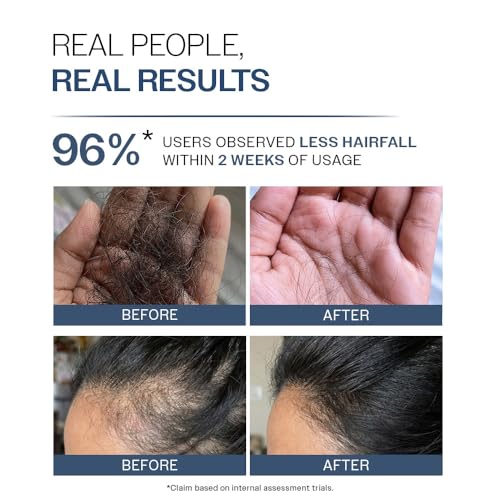 Image of Bare Anatomy Anti-Hair Fall Shampoo | Provides 5x Hair Fall Control | Adenosine, Procapil & Peptides | Strengthens Roots, Reduces Breakage & Cleans Gently | Sulphate & Paraben Free | Unisex | 750ml