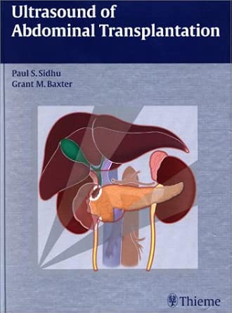 Ultrasound of Abdominal Transplantation / [Edited by] Paul S. Sidhu, Grant M. Baxter ; with Contributions by Syed Babar ... [Et Al.].: Thieme Medical Pub. 333 7th Ave, New York 10001 USA-Wow! eBook