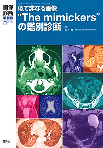 キンドル 無料電子書籍 画像診断2020年増刊号(Vol.40 No.4) 似て非なる画像“The mimickers”の鑑別診断 ( バイ