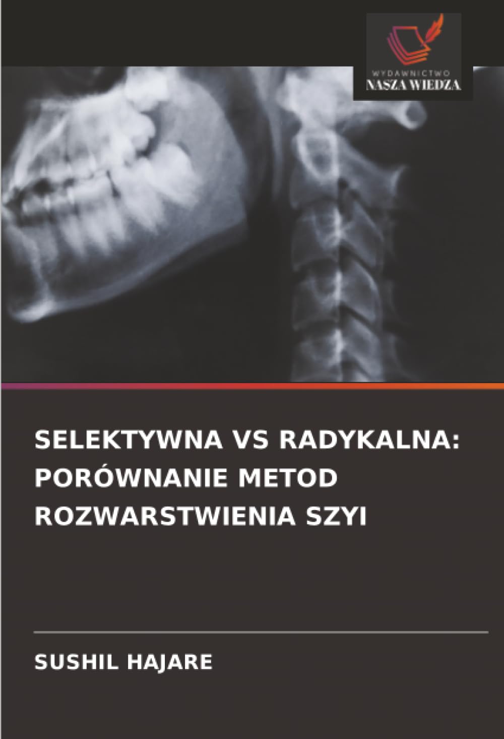 SELEKTYWNA VS RADYKALNA: PORÓWNANIE METOD ROZWARSTWIENIA SZYI