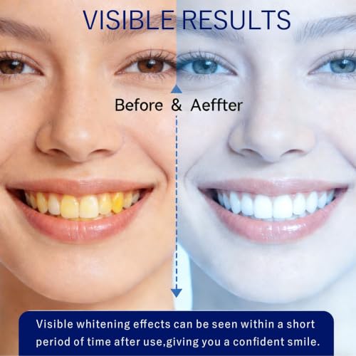 Image of Teeth Whitening Strip Kit, 30 Treatments , 60 Strips, 8 Levels Whiter, Teeth Whitening Kit