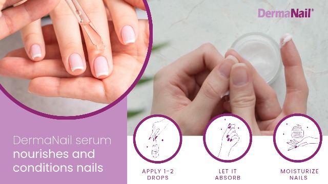 Derma Care Nails: Ultimate Tips for Healthy, Strong Nails