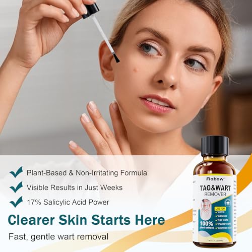 Image of TAG WART Remover, Freeze Off Liquid with 17% Salicylic Acid - Fast-Acting Freeze Off Treatment for Common & Plantar Warts,Flat Wart, Corns - for Feet, Hands & Body (1oz)